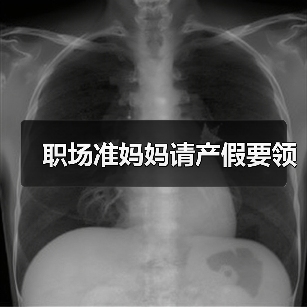 职场准妈妈请产假要领(图1) 职场准妈妈请产假要领(图1)